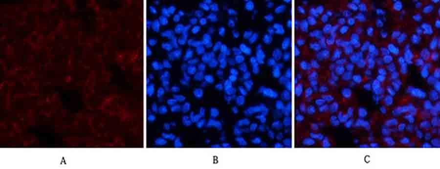 Fig.2. Immunofluorescence analysis of rat lung tissue. 1, Amyloid-β Polyclonal Antibody (red) was diluted at 1:200 (4°C, overnight). 2, Cy3 Labeled secondary antibody was diluted at 1:300 (room temperature, 50min). 3, Picture B: DAPI (blue) 10min. Picture A: Target. Picture B: DAPI. Picture C: merge of A+B.