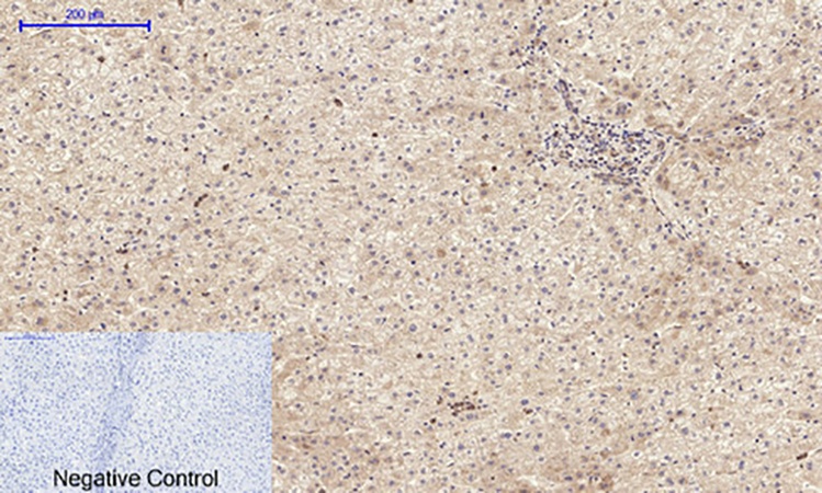 Fig.3. Immunohistochemical analysis of paraffin-embedded human liver tissue. 1, Amyloid-β Polyclonal Antibody was diluted at 1:200 (4°C, overnight). 2, Sodium citrate pH 6.0 was used for antibody retrieval (>98°C, 20min). 3, secondary antibody was diluted at 1:200 (room temperature, 30min). Negative control was used by secondary antibody only.