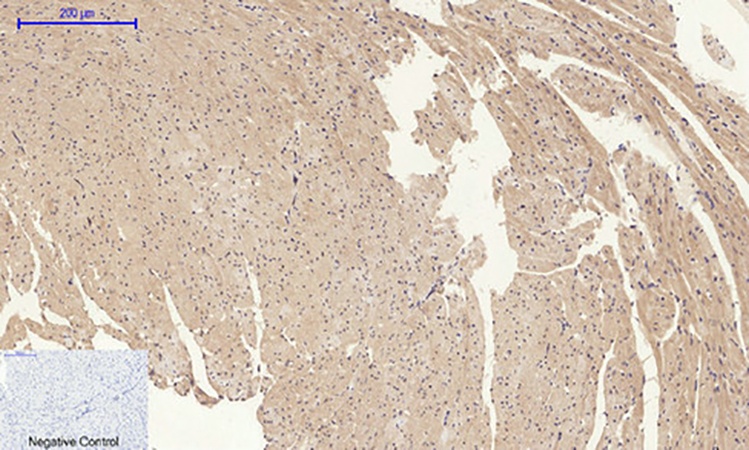 Fig.4. Immunohistochemical analysis of paraffin-embedded mouse heart tissue. 1, Amyloid-β Polyclonal Antibody was diluted at 1:200 (4°C, overnight). 2, Sodium citrate pH 6.0 was used for antibody retrieval (>98°C, 20min). 3, secondary antibody was diluted at 1:200 (room temperature, 30min). Negative control was used by secondary antibody only.