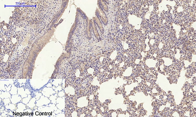 Fig.5. Immunohistochemical analysis of paraffin-embedded rat lung tissue. 1, Amyloid-β Polyclonal Antibody was diluted at 1:200 (4°C, overnight). 2, Sodium citrate pH 6.0 was used for antibody retrieval (>98°C, 20min). 3, secondary antibody was diluted at 1:200 (room temperature, 30min). Negative control was used by secondary antibody only.
