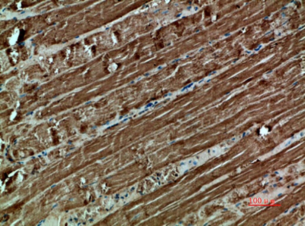 Fig.5. Immunohistochemical analysis of paraffin-embedded human-muscle, antibody was diluted at 1:200.