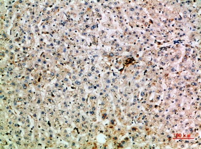 Fig.3. Immunohistochemical analysis of paraffin-embedded human-liver, antibody was diluted at 1:200.
