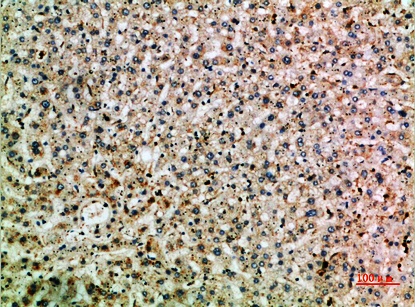 Fig.4. Immunohistochemical analysis of paraffin-embedded human-liver, antibody was diluted at 1:200.