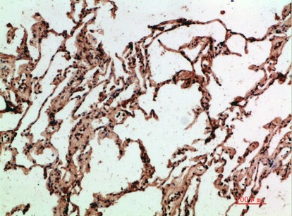 Fig.1. Immunohistochemical analysis of paraffin-embedded human-lung, antibody was diluted at 1:200.
