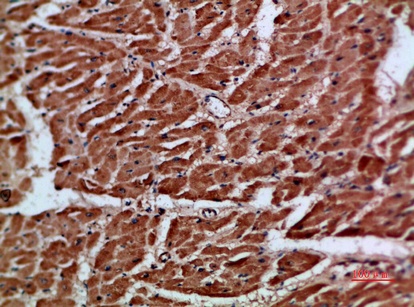 Fig.1. Immunohistochemical analysis of paraffin-embedded human-heart, antibody was diluted at 1:200.