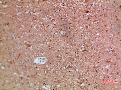 Fig.3. Immunohistochemical analysis of paraffin-embedded human-brain, antibody was diluted at 1:200.
