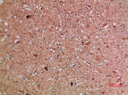 Fig.4. Immunohistochemical analysis of paraffin-embedded human-brain, antibody was diluted at 1:200.