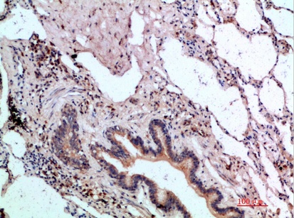 Fig.1. Immunohistochemical analysis of paraffin-embedded human-lung, antibody was diluted at 1:200.