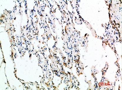 Fig.2. Immunohistochemical analysis of paraffin-embedded human-lung, antibody was diluted at 1:200.