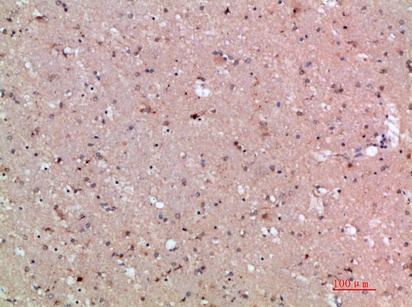 Fig.3. Immunohistochemical analysis of paraffin-embedded human-brain, antibody was diluted at 1:200.