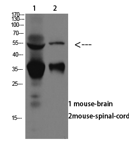 Fig.1. Western blot analysis of SW480 lysate, antibody was diluted at 1:1000. HRP, Goat Anti-Rabbit IgG (Cat #: A21020) secondary antibody was diluted at 1:20000.