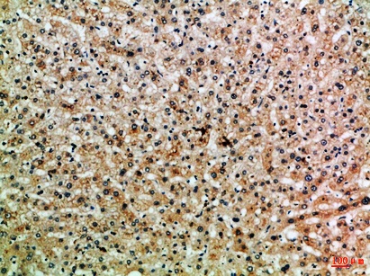 Fig.2. Immunohistochemical analysis of paraffin-embedded Human-liver, antibody was diluted at 1:100.