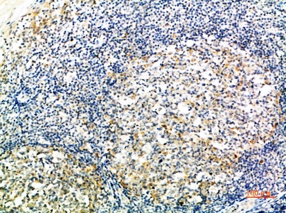Fig.2. Immunohistochemical analysis of paraffin-embedded human-tonsil, antibody was diluted at 1:200.