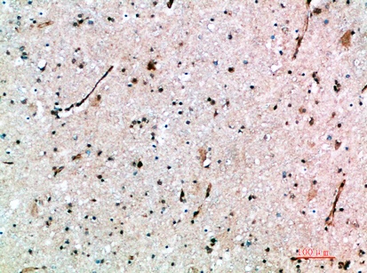 Fig.1. Immunohistochemical analysis of paraffin-embedded human-brain, antibody was diluted at 1:200.