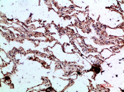 Fig.3. Immunohistochemical analysis of paraffin-embedded human-lung, antibody was diluted at 1:200.