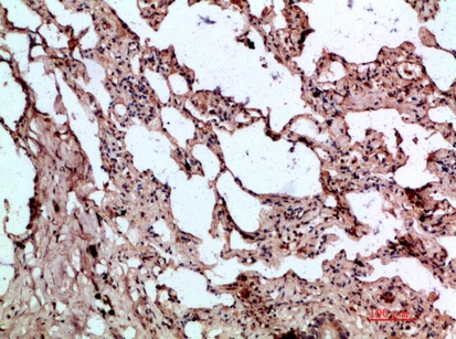 Fig.4. Immunohistochemical analysis of paraffin-embedded human-lung, antibody was diluted at 1:200.