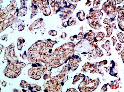 Fig.2. Immunohistochemical analysis of paraffin-embedded Human-placenta, antibody was diluted at 1:100.