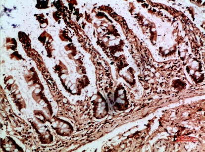 Fig.1. Immunohistochemical analysis of paraffin-embedded human-colon, antibody was diluted at 1:200.
