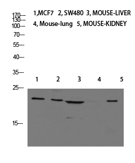 Fig.1. Western blot analysis of Jurkat U937 Raji Mouse-eye lysate, antibody was diluted at 1:1000. HRP, Goat Anti-Rabbit IgG (Cat #: A21020) secondary antibody was diluted at 1:20000.