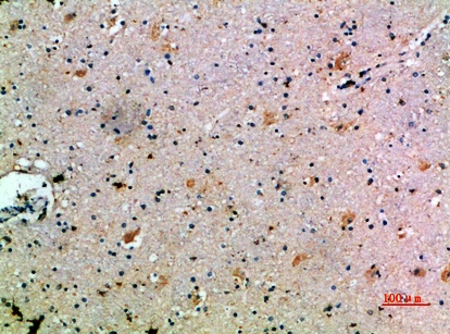 Fig.1. Immunohistochemical analysis of paraffin-embedded human-brain, antibody was diluted at 1:200.