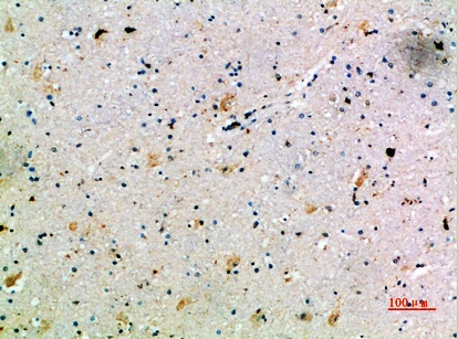 Fig.2. Immunohistochemical analysis of paraffin-embedded human-brain, antibody was diluted at 1:200.