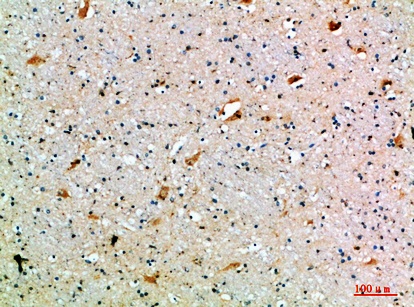 Fig.1. Immunohistochemical analysis of paraffin-embedded human-brain, antibody was diluted at 1:200.