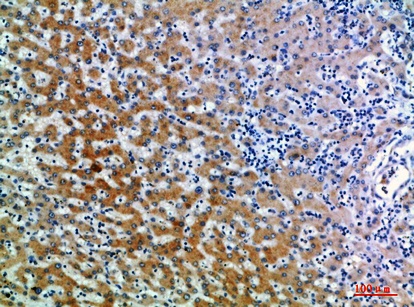 Fig.1. Immunohistochemical analysis of paraffin-embedded human-liver, antibody was diluted at 1:200.