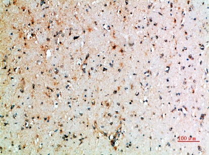 Fig.3. Immunohistochemical analysis of paraffin-embedded human-brain, antibody was diluted at 1:200.
