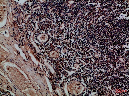 Fig.1. Immunohistochemical analysis of paraffin-embedded Human-tonsil, antibody was diluted at 1:100.