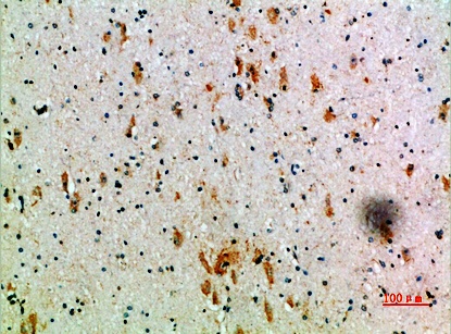 Fig.3. Immunohistochemical analysis of paraffin-embedded human-brain, antibody was diluted at 1:200.