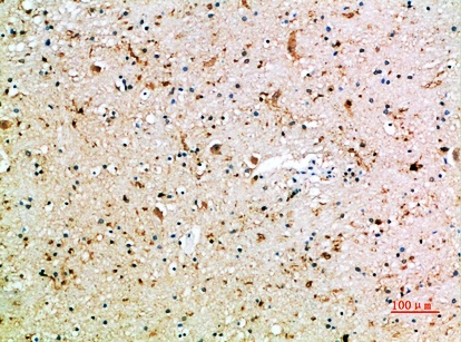 Fig.2. Immunohistochemical analysis of paraffin-embedded human-brain, antibody was diluted at 1:200.