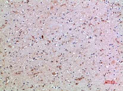 Fig.3. Immunohistochemical analysis of paraffin-embedded human-brain, antibody was diluted at 1:200.