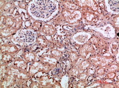 Fig.3. Immunohistochemical analysis of paraffin-embedded human-kidney, antibody was diluted at 1:200.