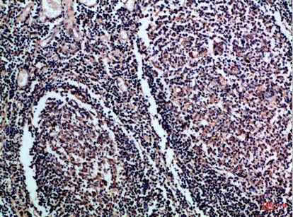 Fig.1. Immunohistochemical analysis of paraffin-embedded Human-tonsil, antibody was diluted at 1:100.