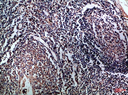 Fig.2. Immunohistochemical analysis of paraffin-embedded Human-tonsil, antibody was diluted at 1:100.