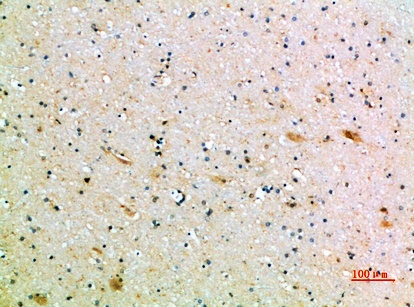 Fig.3. Immunohistochemical analysis of paraffin-embedded human-brain, antibody was diluted at 1:200.