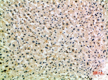 Fig.1. Immunohistochemical analysis of paraffin-embedded human-liver, antibody was diluted at 1:200.