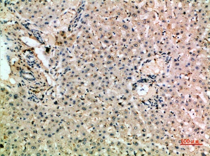 Fig.2. Immunohistochemical analysis of paraffin-embedded human-liver, antibody was diluted at 1:200.