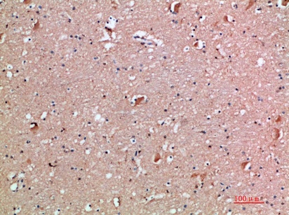 Fig.2. Immunohistochemical analysis of paraffin-embedded human-brain, antibody was diluted at 1:200.