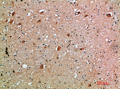 Fig.3. Immunohistochemical analysis of paraffin-embedded human-brain, antibody was diluted at 1:200.