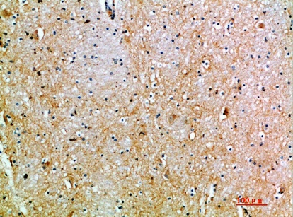 Fig.2. Immunohistochemical analysis of paraffin-embedded human-brain, antibody was diluted at 1:200.