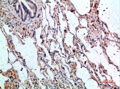 Fig.1. Immunohistochemical analysis of paraffin-embedded human-lung, antibody was diluted at 1:200.