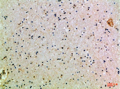 Fig.2. Immunohistochemical analysis of paraffin-embedded Human-brain, antibody was diluted at 1:100.