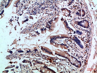 Fig.1. Immunohistochemical analysis of paraffin-embedded Human-colon, antibody was diluted at 1:100.
