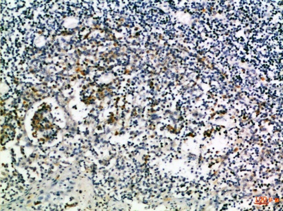 Fig.2. Immunohistochemical analysis of paraffin-embedded Human-tonsil, antibody was diluted at 1:100.