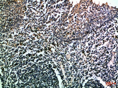 Fig.1. Immunohistochemical analysis of paraffin-embedded Human-tonsil, antibody was diluted at 1:100.