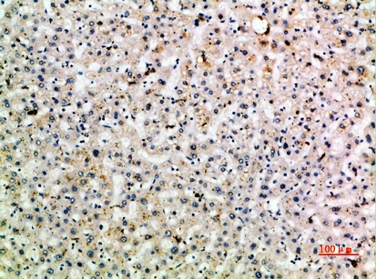 Fig.2. Immunohistochemical analysis of paraffin-embedded human-liver, antibody was diluted at 1:200.