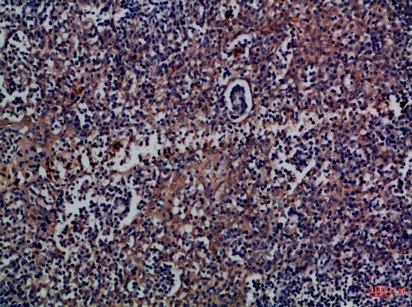 Fig.1. Immunohistochemical analysis of paraffin-embedded Human-tonsil, antibody was diluted at 1:100.