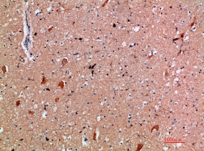 Fig.2. Immunohistochemical analysis of paraffin-embedded human-brain, antibody was diluted at 1:200.