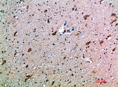 Fig.3. Immunohistochemical analysis of paraffin-embedded human-brain, antibody was diluted at 1:200.